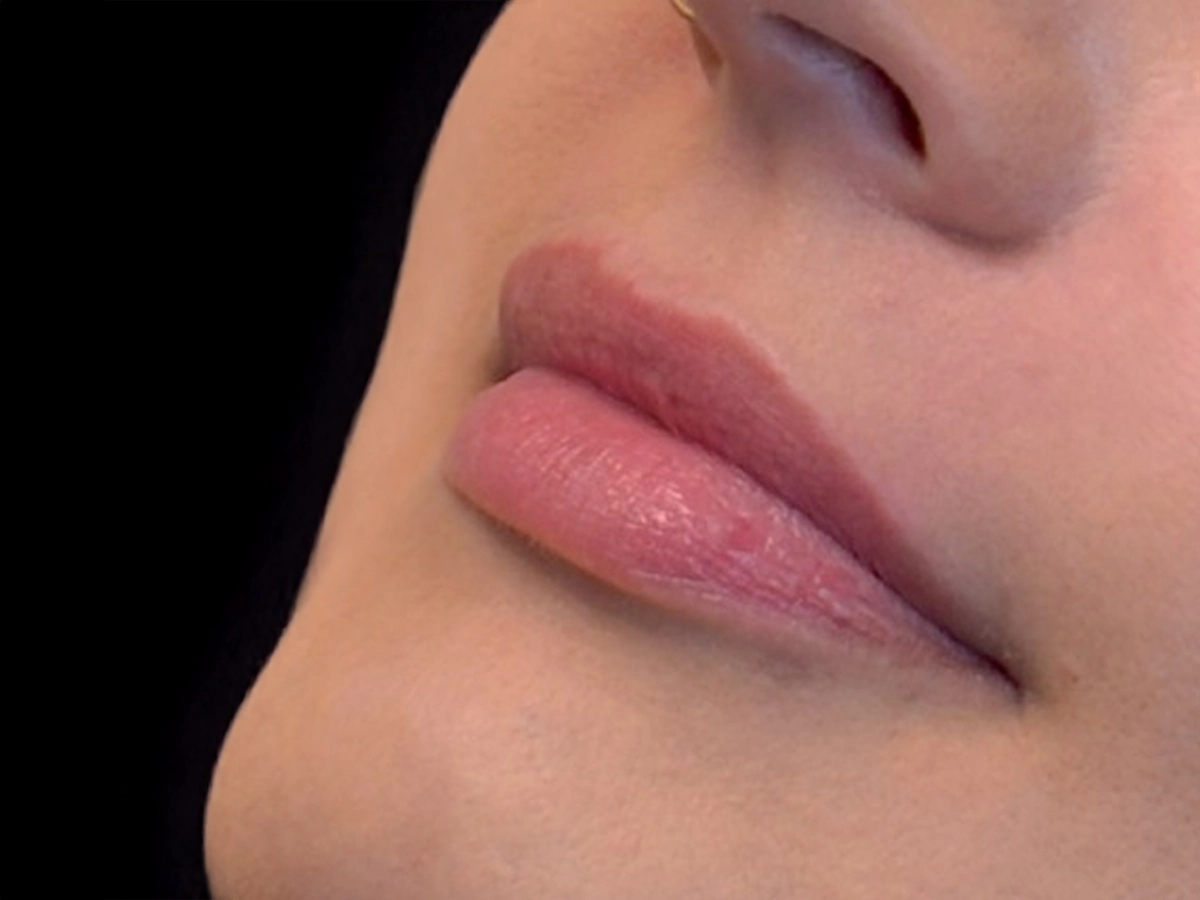 Antes labios