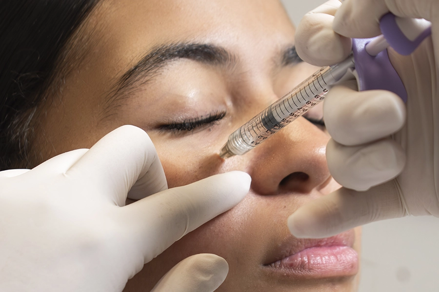 Resultado armonización facial