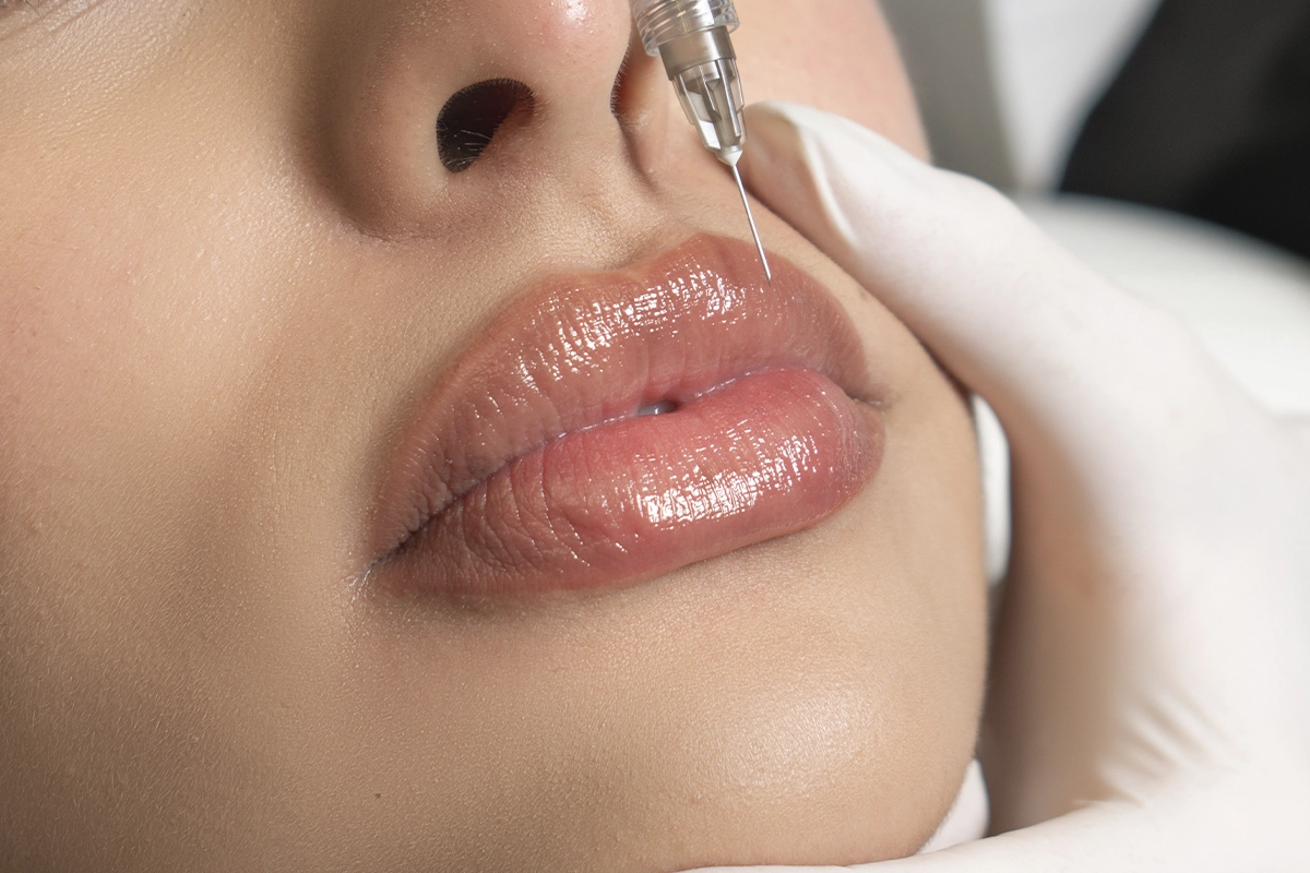 Resultado Russian Lips